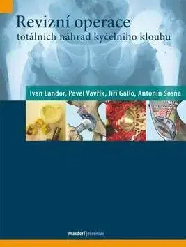 Revizní operace totálních náhrad kyčelního kloubu - Jiří Gallo, Ivan Landor, Pavel Vavřík