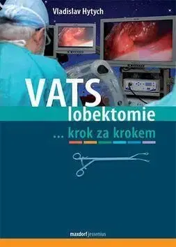 VATS lobektomie - Vladislav Hytych