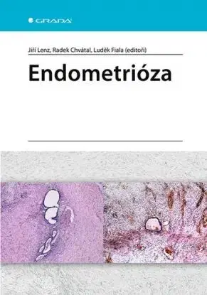 Endometrióza - Jiří Lenz, Radek Chvátal, Luděk Fiala