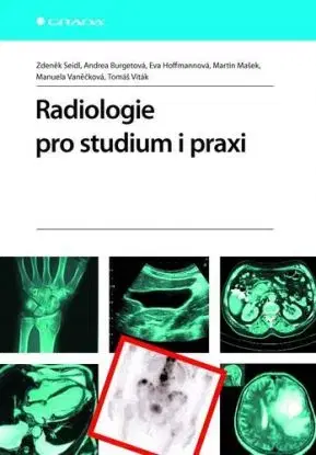 Radiologie pro studium i praxi - Zdeněk Seidl