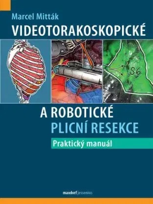 Videotorakoskopické a robotické plicní resekce - Praktický manuál - Marcel Mitták