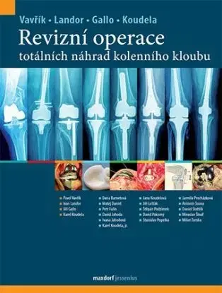 Revizní operace totálních náhrad kolenního kloubu - Jiří Gallo, Ivan Landor, Pavel Vavřík