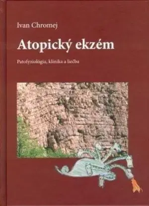 Atopický ekzém - Ivan Chromej