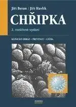 Chřipka, Klinický obraz, prevence a léčba - Jiří Beran, Jiří Havlík
