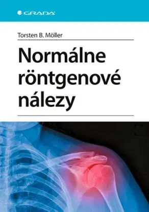 Normálne röntgenové nálezy - Torsten B. Möller
